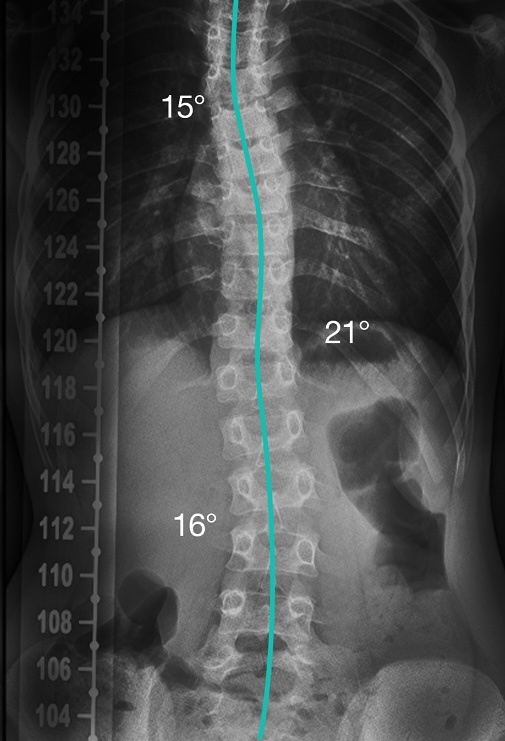 After treatment